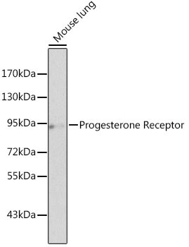Progesterone Receptor Antibody in Western Blot (WB)