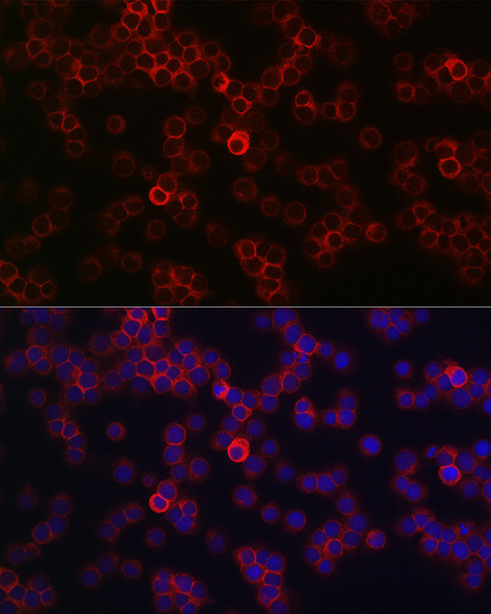 CD45 Antibody in Immunocytochemistry (ICC/IF)