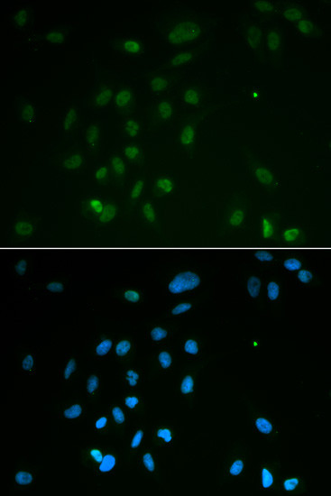 CHK2 Antibody in Immunocytochemistry (ICC/IF)