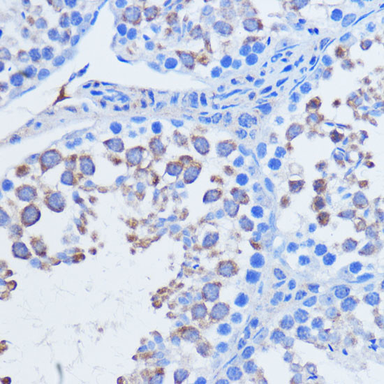 PIWIL1 Antibody in Immunohistochemistry (Paraffin) (IHC (P))