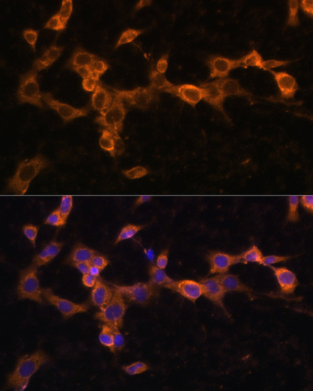 PDGFRB Antibody in Immunocytochemistry (ICC/IF)