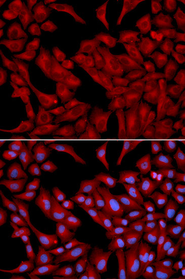 Dynactin 2 Antibody in Immunocytochemistry (ICC/IF)