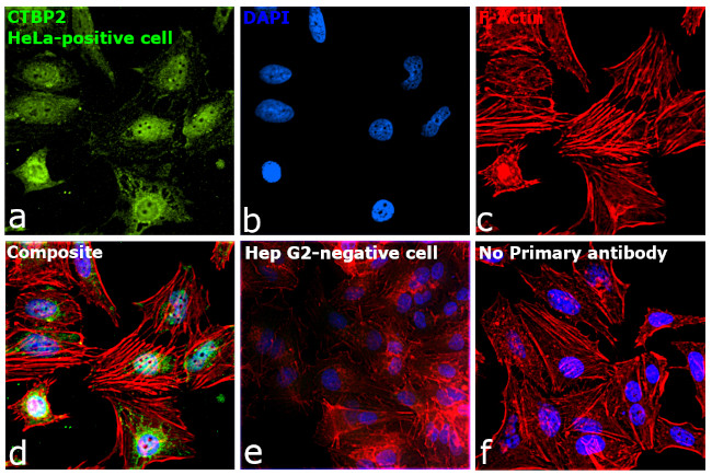 CtBP2 Antibody in Immunocytochemistry (ICC/IF)