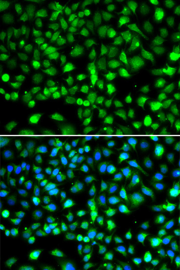 SMYD1 Antibody in Immunocytochemistry (ICC/IF)