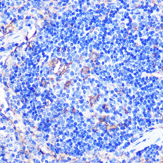 CD86 Antibody in Immunohistochemistry (Paraffin) (IHC (P))