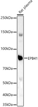 EPB41 Antibody in Western Blot (WB)