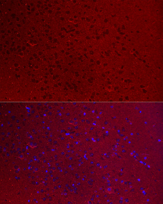 GNAO1 Antibody in Immunocytochemistry (ICC/IF)