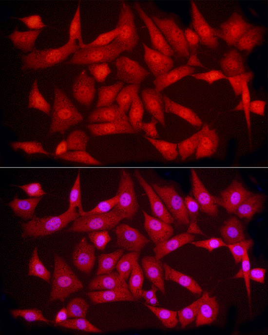 PCBP2 Antibody in Immunocytochemistry (ICC/IF)