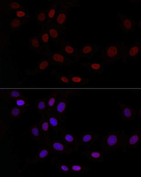 LAP2 Antibody in Immunocytochemistry (ICC/IF)