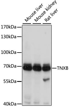 Tenascin X Antibody in Western Blot (WB)