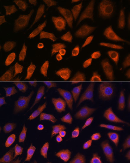 N-WASP Antibody in Immunocytochemistry (ICC/IF)