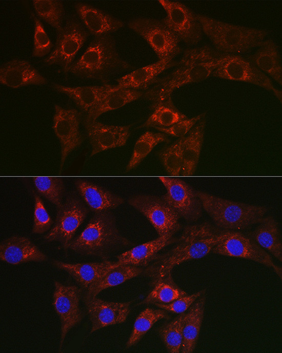 ATG4A Antibody in Immunocytochemistry (ICC/IF)