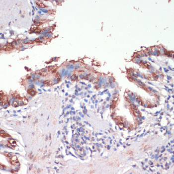 MSI1 Antibody in Immunohistochemistry (Paraffin) (IHC (P))