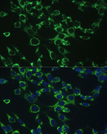 COX5B Antibody in Immunocytochemistry (ICC/IF)
