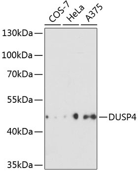 MKP2 Antibody in Western Blot (WB)