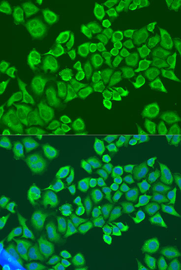 IGF2BP2 Antibody in Immunocytochemistry (ICC/IF)
