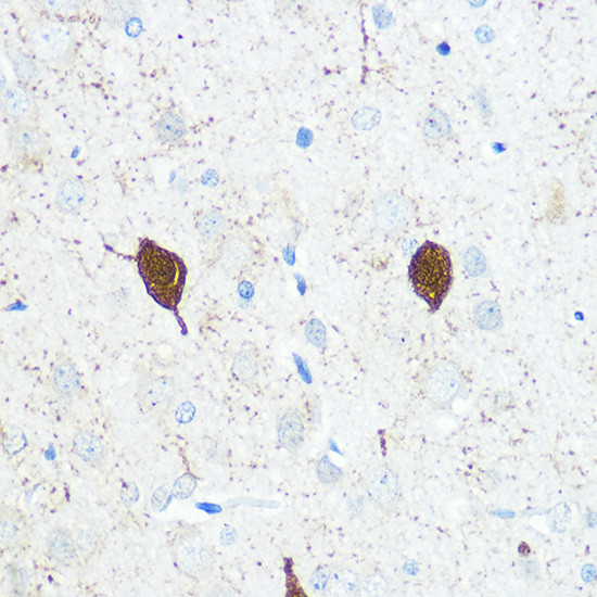 Parvalbumin Antibody in Immunohistochemistry (Paraffin) (IHC (P))