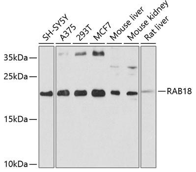 RAB18 Antibody in Western Blot (WB)