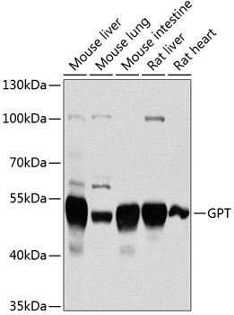 GPT Antibody in Western Blot (WB)