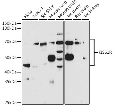 KISS1R Antibody in Western Blot (WB)