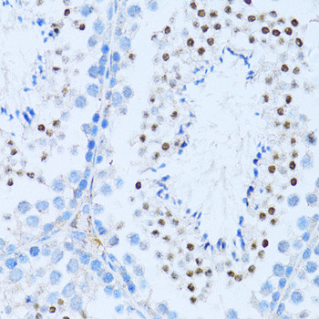 NFkB p52 Antibody in Immunohistochemistry (Paraffin) (IHC (P))