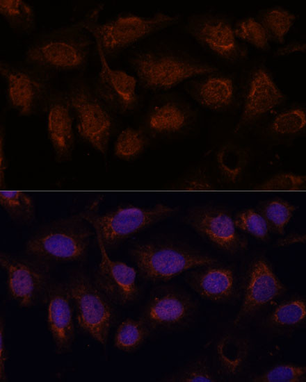 PP2A beta Antibody in Immunocytochemistry (ICC/IF)