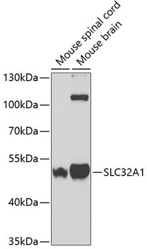 VGAT Antibody in Western Blot (WB)