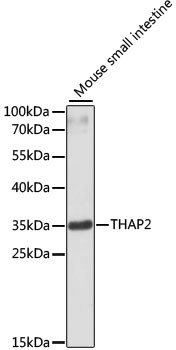 THAP2 Antibody in Western Blot (WB)