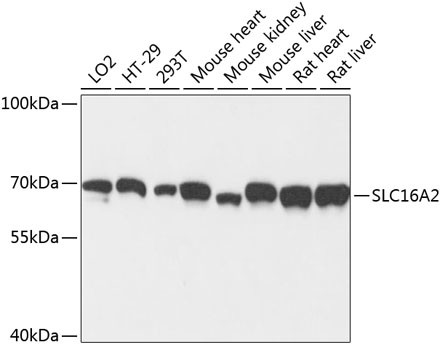 SLC16A2 Antibody in Western Blot (WB)