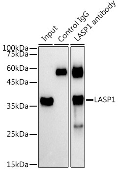 LASP1 Antibody in Immunoprecipitation (IP)