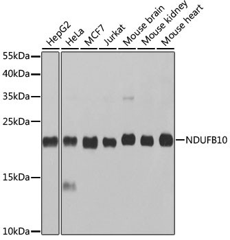 NDUFB10 Antibody in Western Blot (WB)