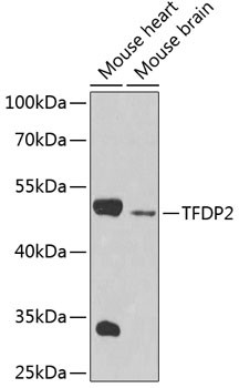 DP2 Antibody in Western Blot (WB)