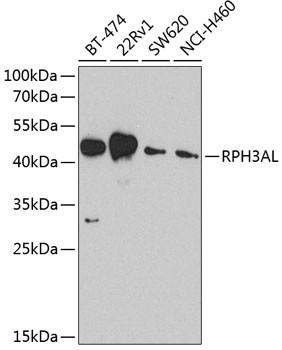 RPH3AL Antibody in Western Blot (WB)