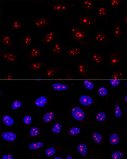 MYBBP1A Antibody in Immunocytochemistry (ICC/IF)