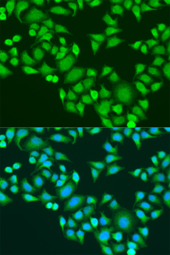 IGF2BP3 Antibody in Immunocytochemistry (ICC/IF)
