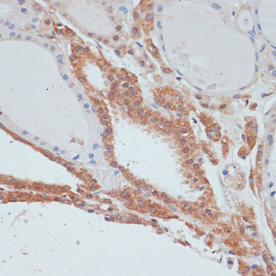 MYCBP Antibody in Immunohistochemistry (Paraffin) (IHC (P))