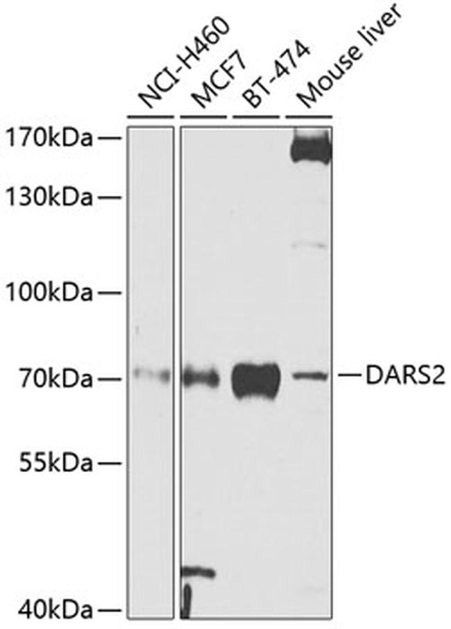 AspRS Antibody in Western Blot (WB)