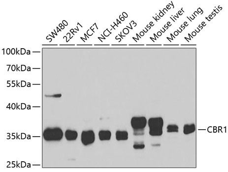 CBR1 Antibody in Western Blot (WB)