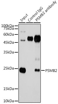 PSMB2 Antibody in Immunoprecipitation (IP)