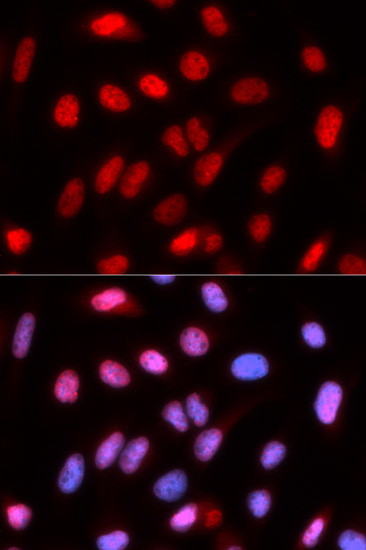 RFC4 Antibody in Immunocytochemistry (ICC/IF)
