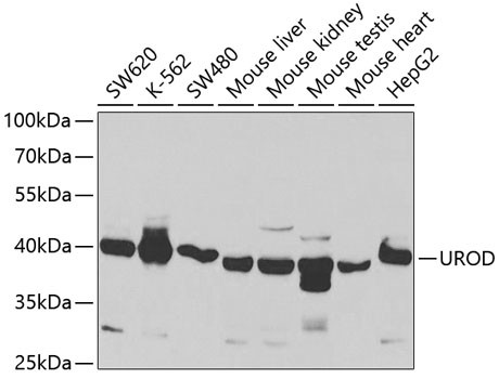 UROD Antibody in Western Blot (WB)