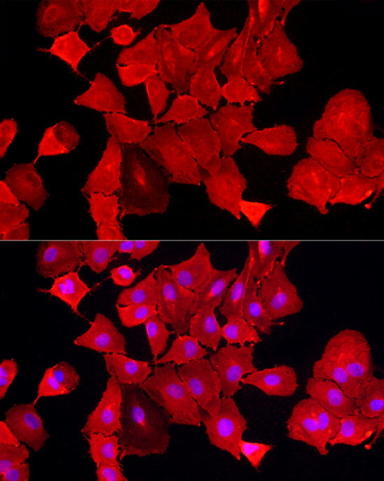 ALDH3A1 Antibody in Immunocytochemistry (ICC/IF)