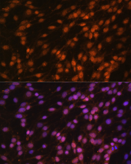FUBP1 Antibody in Immunocytochemistry (ICC/IF)