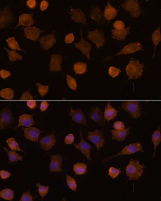 ICAM-1 Antibody in Immunocytochemistry (ICC/IF)