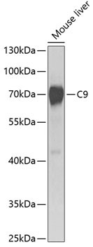 Complement C9 Antibody in Western Blot (WB)