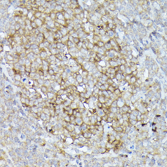 CD10 Antibody in Immunohistochemistry (Paraffin) (IHC (P))
