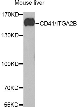 CD41 Antibody in Western Blot (WB)