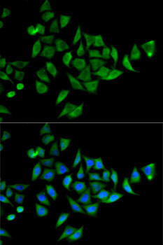 DOK1 Antibody in Immunocytochemistry (ICC/IF)