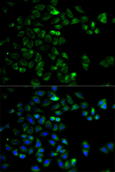 HTRA2 Antibody in Immunocytochemistry (ICC/IF)