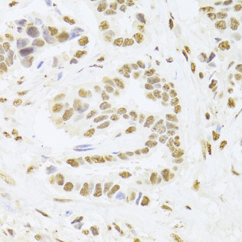 PHAP I Antibody in Immunohistochemistry (Paraffin) (IHC (P))